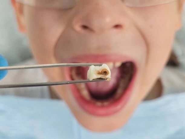 Best Mobile Emergency Dentist in Washgton, IN